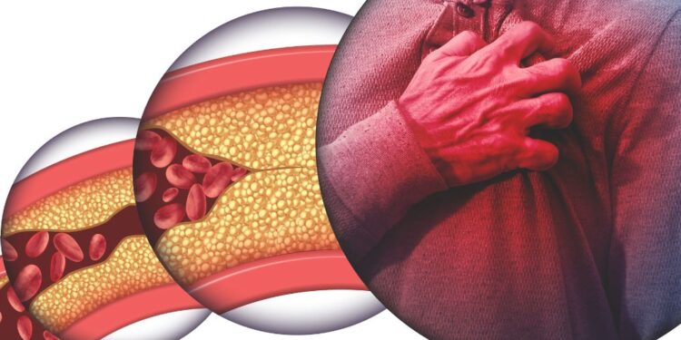 Starodavni recept iz Nemčije: Čisti arterije in preprečuje bolezni