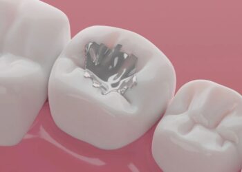 Od prihodnjega leta prepovedane amalgamske zalivke v EU