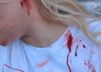 Dekle pretepeno zaradi podpore Trumpu (VIDEO)