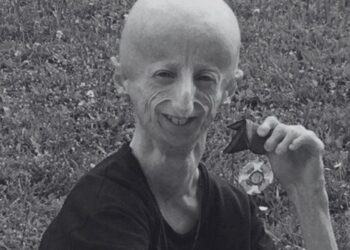 Sammy Basso – 28 let poguma in upanja za bolnike s progerijo