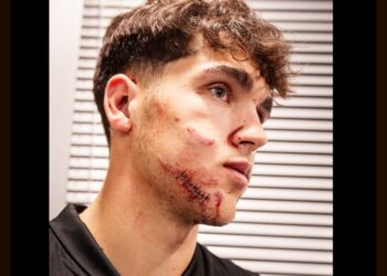 Barcelona nad Crveno zvezdo s 5:2, mladi Cubarsi po trčenju pridobil 10 šivov (FOTO)