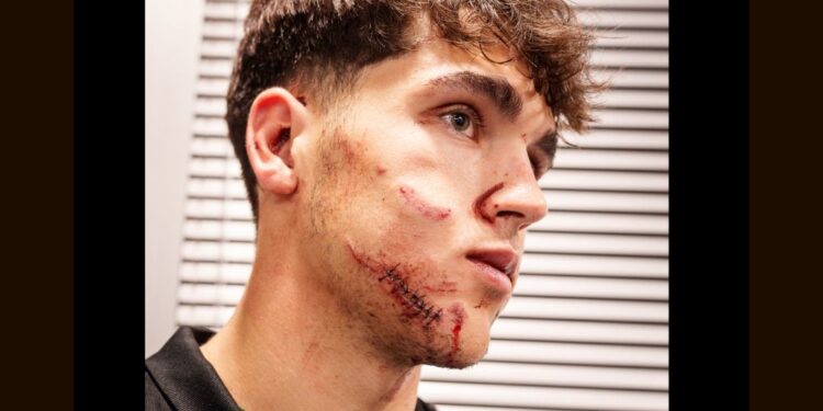 Barcelona nad Crveno zvezdo s 5:2, mladi Cubarsi po trčenju pridobil 10 šivov (FOTO)