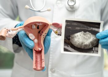 Naravna moč proti raku materničnega vratu